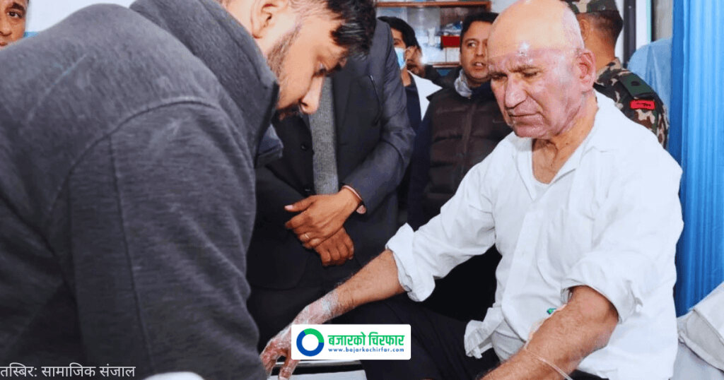 पोखरामा बेलुन विस्फोटपछि घाइते भएका अर्थमन्त्री पौडेल र मेयर सँगको भेटघाट पूर्ण रूपमा बन्द